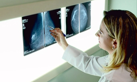 Kanceri i gjirit Kanceri i gjirit