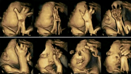 Pamjet e nje foshnje ne barkun e nje nene duhanpirese